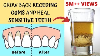 Heal Receding Gums and Grow Back  Treat Sensitive Teeth and Reverse Receding Gums  Gingivitis [upl. by Atsok]