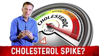 Intermittent Fasting and Ketosis May Spike Your Cholesterol – Dr Berg [upl. by Thebault]