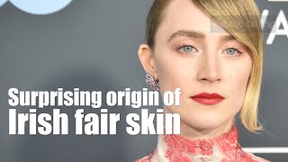 Surprising origin of Irish fair skin far away from Ireland [upl. by Notfilc]