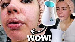 I Tested The Best FACIAL STEAMER On Amazon [upl. by Linzy]