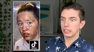 Specialist Reacts to Skin Care TikTok FAILS [upl. by Arratahs]