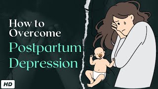 Postpartum Depression [upl. by Arvin]