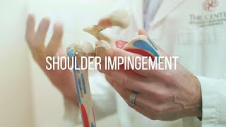 Shoulder Impingement Causes and Treatment [upl. by Pazit28]