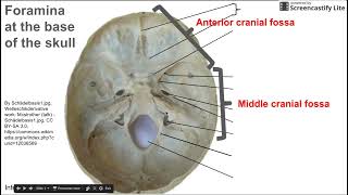 Foramina at base of skull [upl. by Waylon]