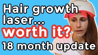 iRestore hair growth laser 18 month update Is it worth it Dr Dray [upl. by Ednutabab]