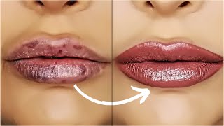 BALANCING UNEVEN LIPS WITH FILLER  ADDING LIP VOLUME  VIVA Skin Clinics [upl. by Asiel709]