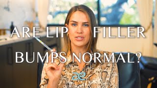 Are Lip Filler Bumps Normal • Aesthetic MdR [upl. by Cloris]