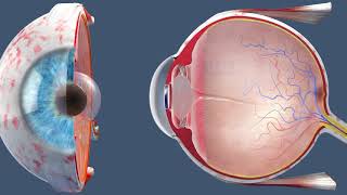 Cataract Surgery  Inside the OR [upl. by Nanaek]