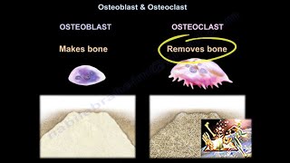 Osteoarthritis vs Rheumatoid arthritis in 2 mins [upl. by Lothaire556]