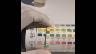 UTI dipstick test Urine Analysis [upl. by Gilmour]