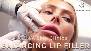 What Are Lip Filler Swelling Stages and Timelines  Dr Jonathan Sykes [upl. by Cam410]