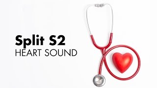 Fixed Split S2  Heart Sounds  MEDZCOOL [upl. by Ecinahc]