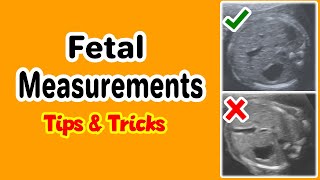 Fetal Measurements Tips and Tricks [upl. by Khosrow]