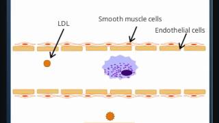 Atherosclerosis [upl. by Radke]