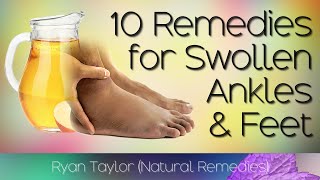 10 Home Remedies for Swollen Feet and Ankles [upl. by Nodlehs]