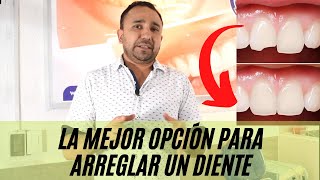 ¿Qué es mejor para dientes frontales CARILLAS ó RESINA [upl. by Rather]