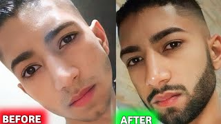 Mintop minoxidil 5 beard  dr reddy minoxidil 5 results  dr reddy minoxidil 5 beard results [upl. by Pedersen62]