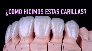 Cómo se hacen las carillas dentales  Proceso realización carillas dentalesDr Roberto Wuotto [upl. by Nylyaj]