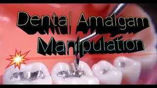 Dental Amalgam Manipulation [upl. by Honan]