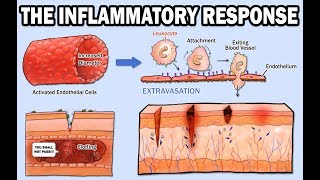 THE INFLAMMATORY RESPONSE [upl. by Ataynik]