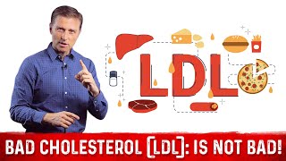 What is LDL Cholesterol – DrBerg on LDL Bad Cholesterol Part 4 [upl. by Lolanthe]