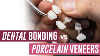 Dental Bonding vs Porcelain Veneers  Which Should I Get [upl. by Jeri]