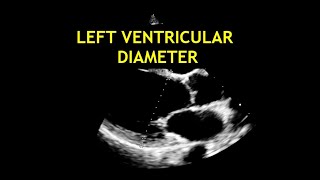 How to measure the LEFT VENTRICULAR DIAMETER Echocardiography [upl. by Spearing]