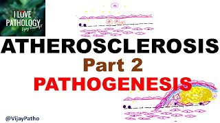 ATHEROSCLEROSIS  Part 2 Pathogenesis [upl. by Alad]