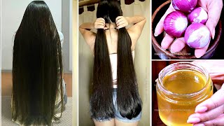 1 Week Challenge  Grow Your Hair Super Faster  After Doing this Your Hair will Never Stop Growing [upl. by Dlonyar977]