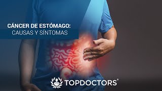 Cáncer de Estómago causas y síntomas [upl. by Younger745]