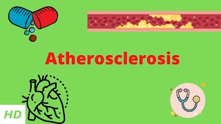 Atherosclerosis Symptoms and Diagnosis [upl. by Leanatan]