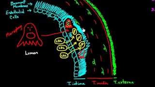 Atherosclerosis  Part 1 [upl. by Warrin]