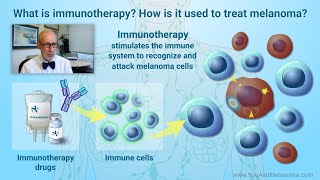 How is melanoma treated with immunotherapy [upl. by Atteuqihc229]