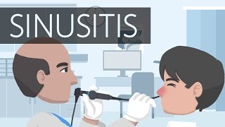 What is Sinusitis [upl. by Esinrahs]