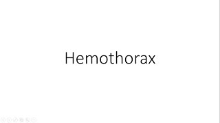 Hemothorax  General Surgery [upl. by Saleem]