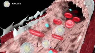 Development of atherosclerosis [upl. by Nimzay]