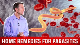 Best Home Remedies for Parasites – Dr Berg [upl. by Onit]