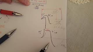 ECG made easy  Hyperkalemia amp Hypokalemia [upl. by Samuelson]