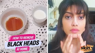 How To Remove Blackheads At Home  DIY Blackhead Removal Face Mask amp Scrub  Skin Secrets  Femina [upl. by Aidyn]