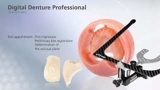 Digital Denture – first Appointment [upl. by Aseiram]