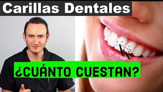 Carillas Dentales  ¿Qué son y Cuánto cuestan  Precios actuales [upl. by Adlei552]