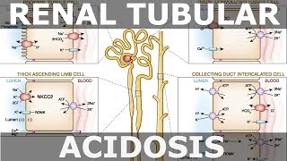 Renal Tubular Acidosis [upl. by Eylk]