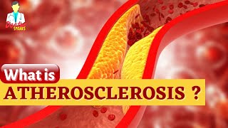 Atherosclerosis Causes and Solutions [upl. by Shae]