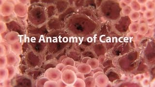 What Is Cancer What Causes Cancer amp How Is It Treated [upl. by Ennaylloh]