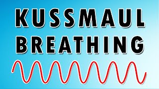 Kussmaul breathing in under 2 mins [upl. by Vasilek663]