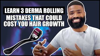 3 Derma Rolling MISTAKES that could cost you hair growth [upl. by Clorinde]