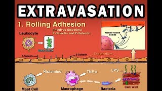 EXTRAVASATION [upl. by Asamot]