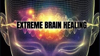 EXTREME BRAIN HEALING In 30 Minutes  Powerful Neuroplasticity Stimulation  Purest RIFE Frequency [upl. by Anuayek]