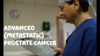 About Advanced Metastatic Prostate Cancer [upl. by Fesuoy]