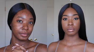 NO FOUNDATION Natural Makeup Look  Dark Spots amp Hyperpigmentation [upl. by Cailly344]